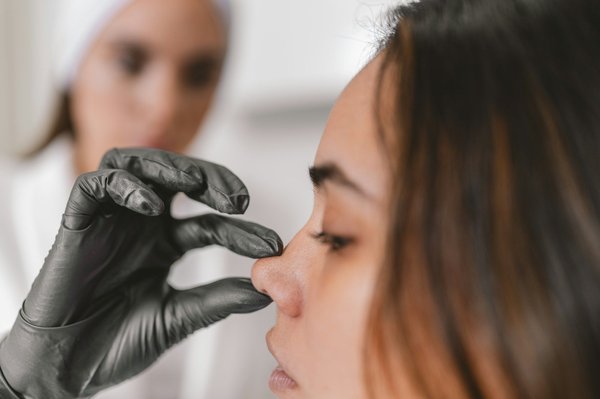 Chirurgie nez : tout savoir sur la rhinoplastie à Marseille